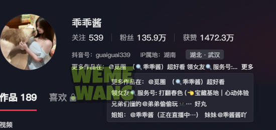 乖乖酱觅圈的反差魅力，整形黑历史咋回事？-WM图库